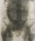 Product Röntgenbilde. 1918. thumbnail