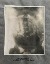 Product Röntgenbilde. 1918. thumbnail